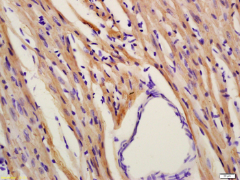 MYL3 Rabbit Polyclonal Antibody