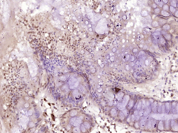 MSH6 Rabbit Polyclonal Antibody