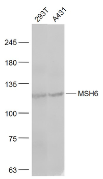 MSH6 Rabbit Polyclonal Antibody