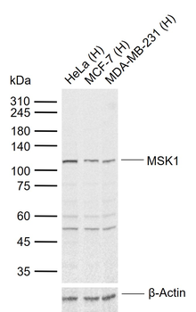 MSK1 Rabbit Polyclonal Antibody