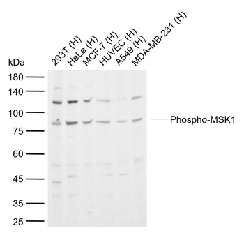 Phospho-MSK1 (Ser212) Rabbit Polyclonal Antibody