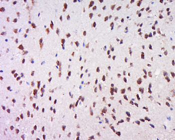 Phospho-MSK1 (Ser212) Rabbit Polyclonal Antibody