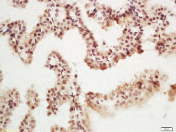 Phospho-MSK1 (Ser376) Rabbit Polyclonal Antibody