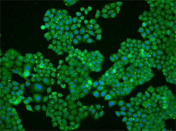 Phospho-MSK1 (Thr581) Rabbit Polyclonal Antibody