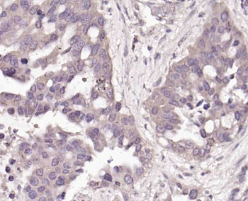 Phospho-MSK1 (Thr581) Rabbit Polyclonal Antibody