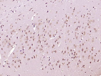 Phospho-MSK1 (Thr581) Rabbit Polyclonal Antibody