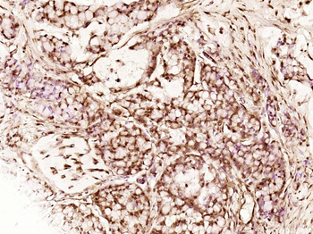 MST1 Rabbit Polyclonal Antibody