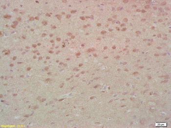 MST1 Rabbit Polyclonal Antibody