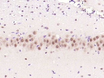 Phospho-mTOR (Ser2448) Rabbit Polyclonal Antibody