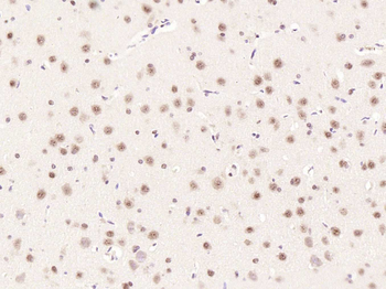 Phospho-mTOR (Ser2448) Rabbit Polyclonal Antibody