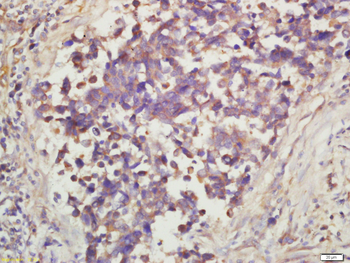 Phospho-mTOR (Ser2448) Rabbit Polyclonal Antibody