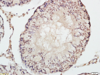 Phospho-mTOR (Ser2448) Rabbit Polyclonal Antibody