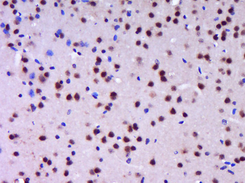 Phospho-mTOR (Thr2446) Rabbit Polyclonal Antibody