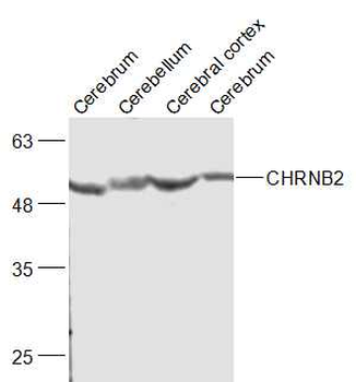 CHRNB2 Rabbit Polyclonal Antibody