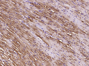 CLIC1 Rabbit Polyclonal Antibody