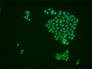 NCOA3 Rabbit Polyclonal Antibody
