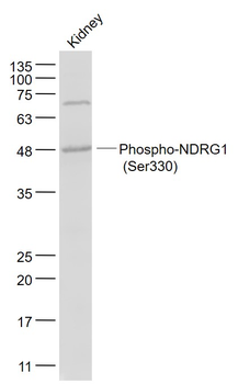 Phospho-NDRG1 (Ser330) Rabbit Polyclonal Antibody