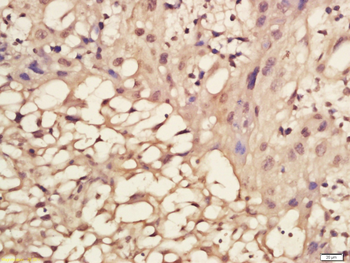 Phospho-NDRG1 (Ser330) Rabbit Polyclonal Antibody