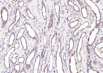 NDUFS1 Rabbit Polyclonal Antibody