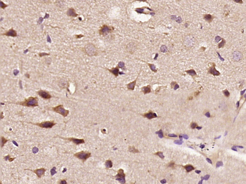 Phospho-NF1 (Ser2817) Rabbit Polyclonal Antibody