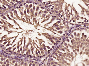 Phospho-NF1 (Ser2817) Rabbit Polyclonal Antibody