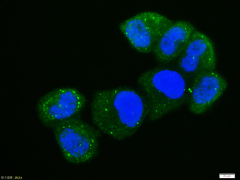 Phospho-NFKB p65 (Ser468) Rabbit Polyclonal Antibody