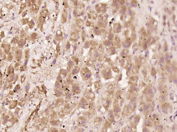Phospho-NFKB p65 (Ser529) Rabbit Polyclonal Antibody