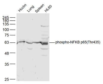 Phospho-NFKB p65 (Thr435) Rabbit Polyclonal Antibody
