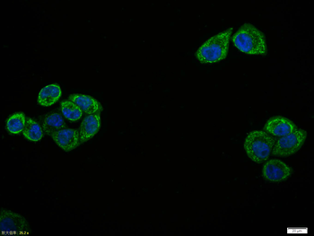 Phospho-NFKB p65 (Thr435) Rabbit Polyclonal Antibody