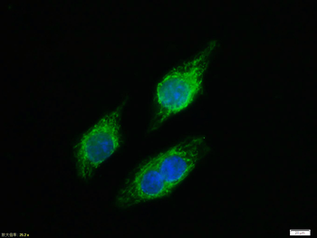 Phospho-NFKB p65 (Thr435) Rabbit Polyclonal Antibody