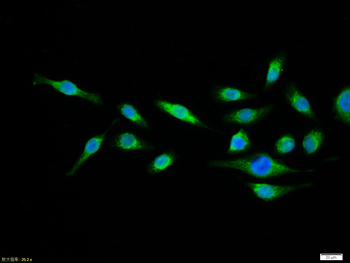 Phospho-NFKB p65 (Thr435) Rabbit Polyclonal Antibody