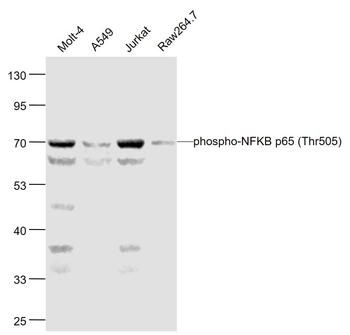 Phospho-NFKB p65 (Thr505) Rabbit Polyclonal Antibody