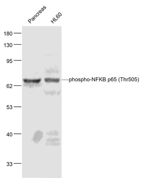 Phospho-NFKB p65 (Thr505) Rabbit Polyclonal Antibody