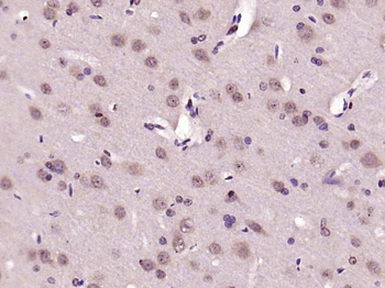 Phospho-NFKB1 (Ser927) Rabbit Polyclonal Antibody