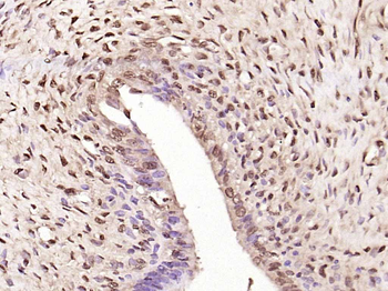 Phospho-NFKB1 (Ser927) Rabbit Polyclonal Antibody