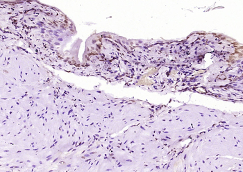 Phospho-NFKB1 (Ser932) Rabbit Polyclonal Antibody