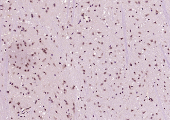 Phospho-NFKB1 (Ser932) Rabbit Polyclonal Antibody