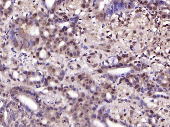 Phospho-NFKB1 (Ser903) Rabbit Polyclonal Antibody