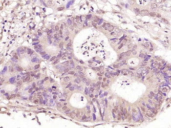 Phospho-NFKB1 (Ser903) Rabbit Polyclonal Antibody