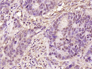 Phospho-NFKB1 (Ser907) Rabbit Polyclonal Antibody