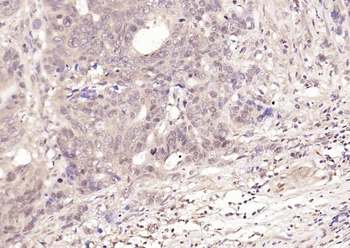 Phospho-NFKB1 (Ser337) Rabbit Polyclonal Antibody