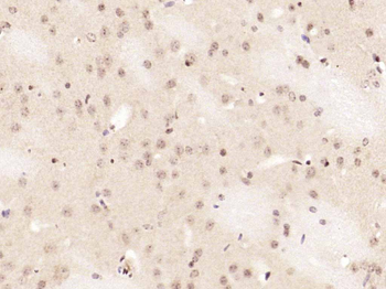 Phospho-NFKB1 (Ser337) Rabbit Polyclonal Antibody