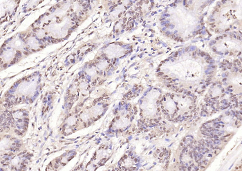 Phospho-NFKB1 (Ser893) Rabbit Polyclonal Antibody