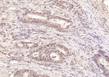 Phospho-NFKB1 (Ser893) Rabbit Polyclonal Antibody