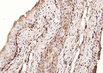 Phospho-NFKB1 (Ser893) Rabbit Polyclonal Antibody