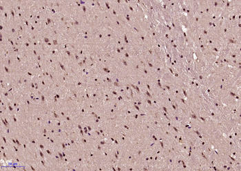Phospho-NFKB1 (Ser893) Rabbit Polyclonal Antibody