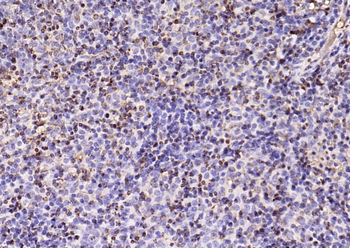 Phospho-NFKB1 (Ser893) Rabbit Polyclonal Antibody