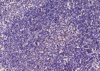 Phospho-NFKB1 (Ser893) Rabbit Polyclonal Antibody