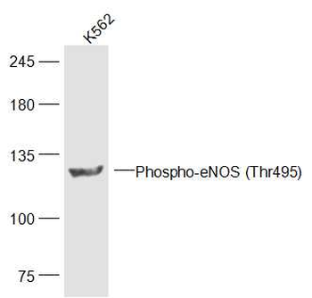 Phospho-eNOS (Thr495) Rabbit Polyclonal Antibody