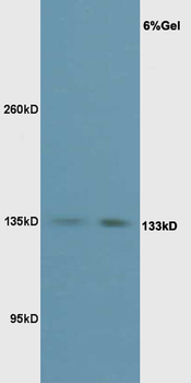 Phospho-eNOS (Thr495) Rabbit Polyclonal Antibody